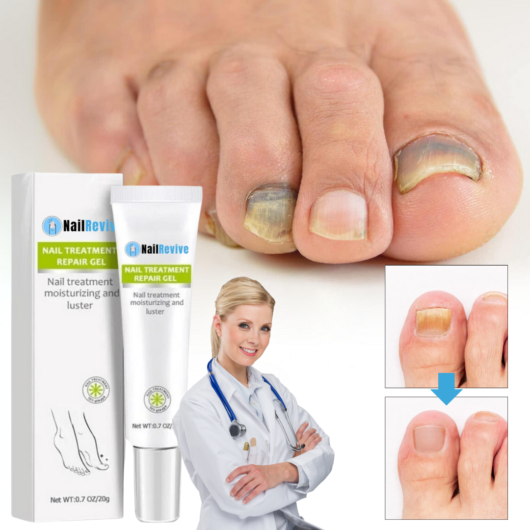 NailRevive™ | תגיד שלום לציפורניים פטרייתיות תוך 7 ימים בלבד!