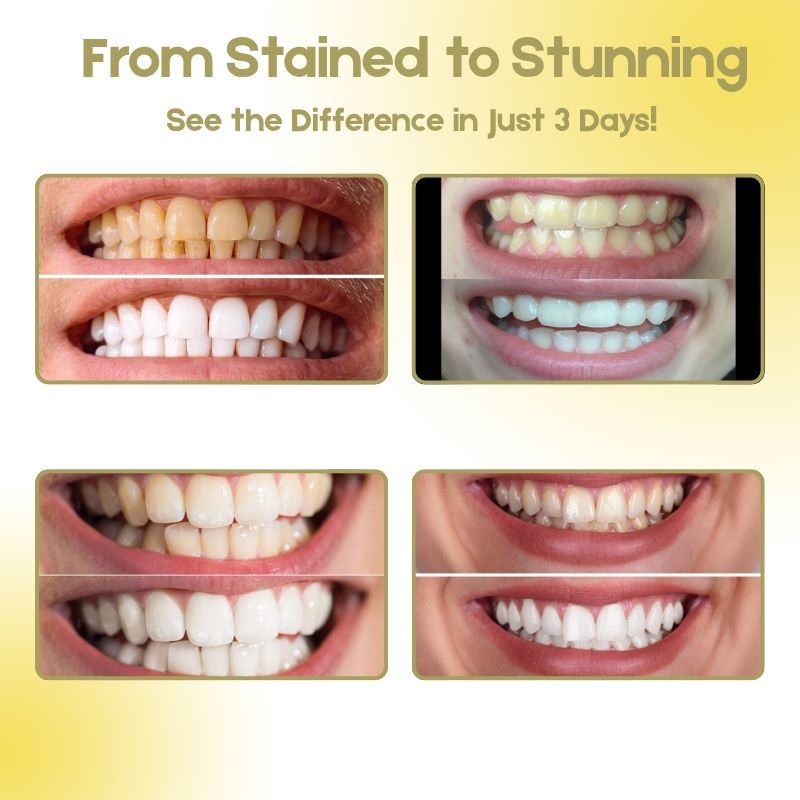 RadiantMint™ | Enamel-Safe Whitening Toothpaste