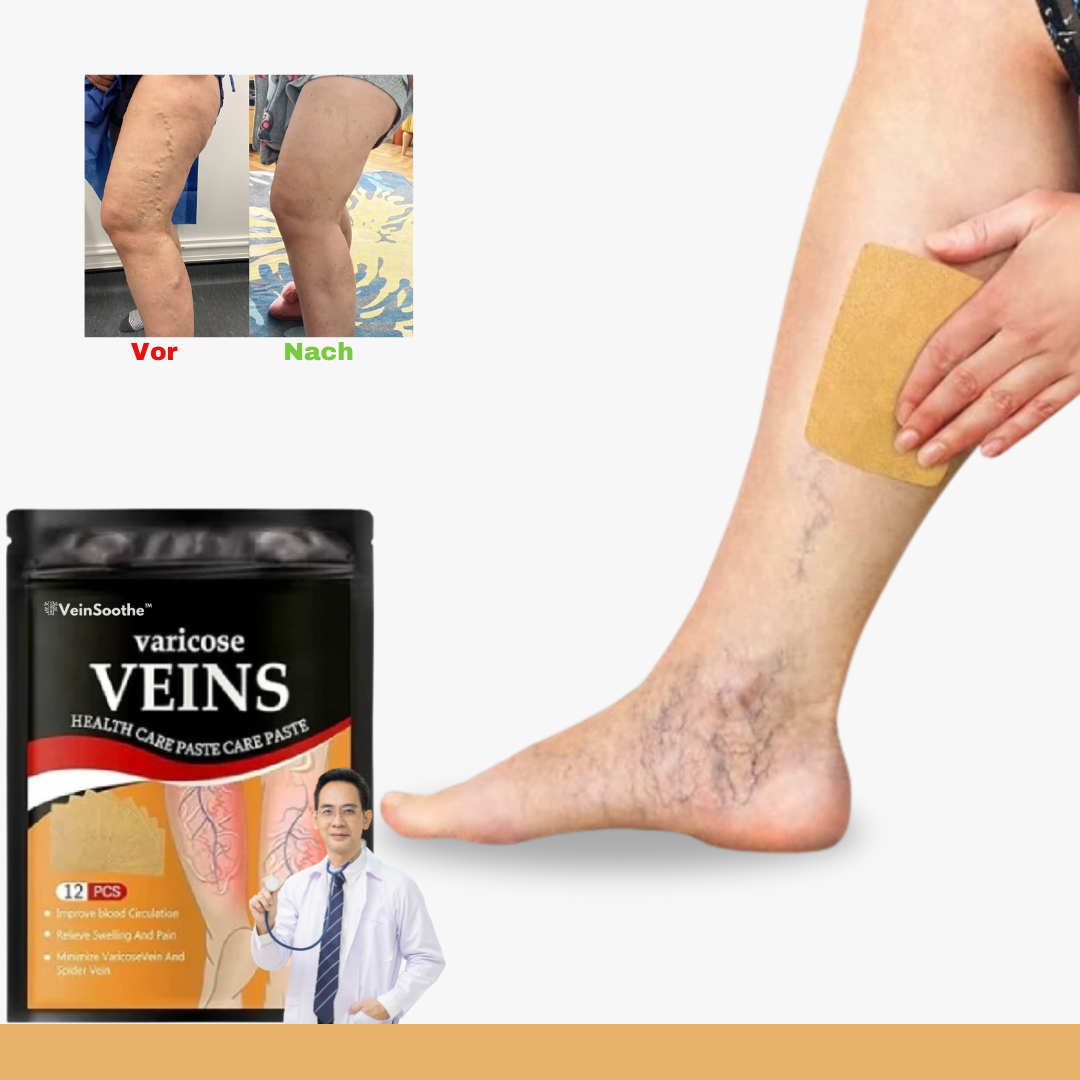 ™VeinSoothe | הכניעו את כאבי הוורידים הכרוניים!