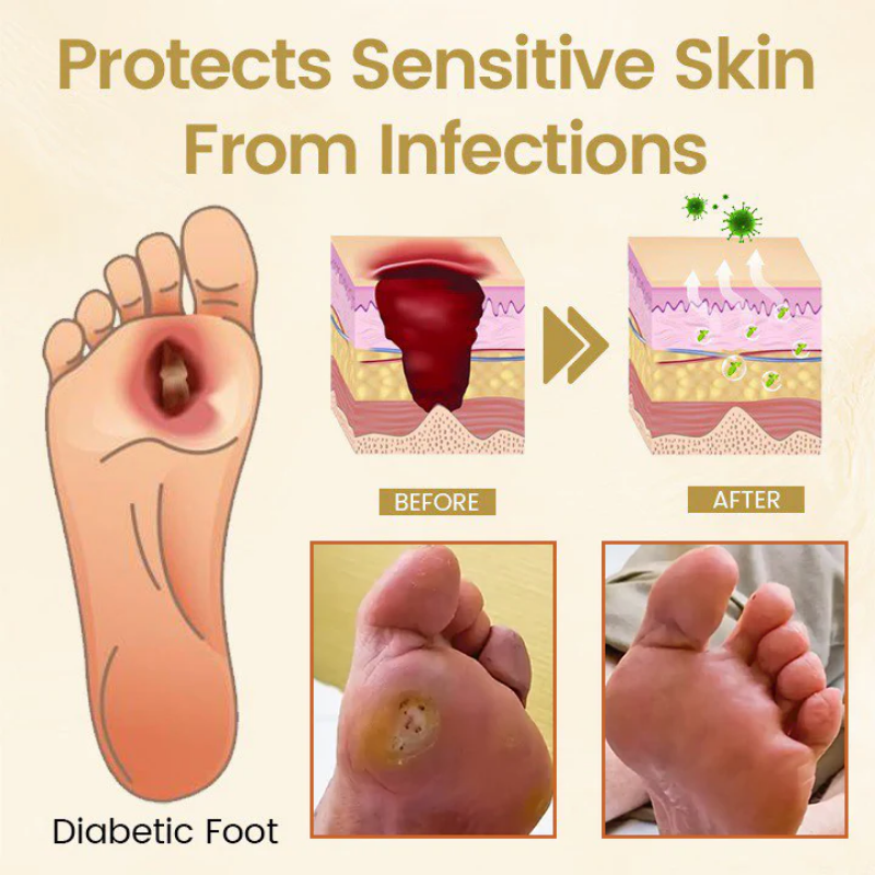 SootheStep™ | Foot Healing Spray