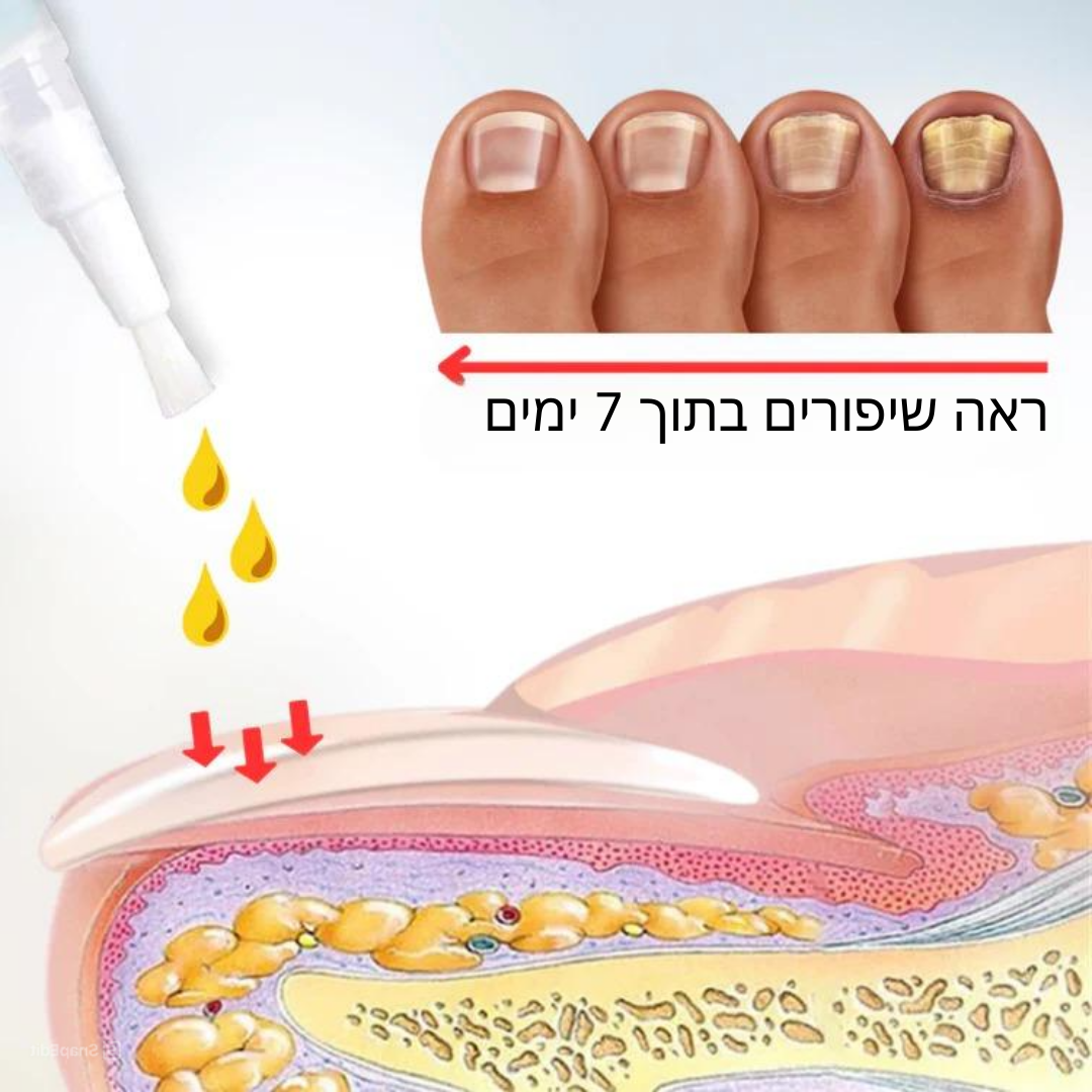 NailRevive™ | תגיד שלום לציפורניים פטרייתיות תוך 7 ימים בלבד!