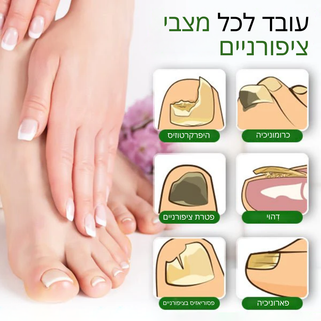 NailRevive™ | תגיד שלום לציפורניים פטרייתיות תוך 7 ימים בלבד!