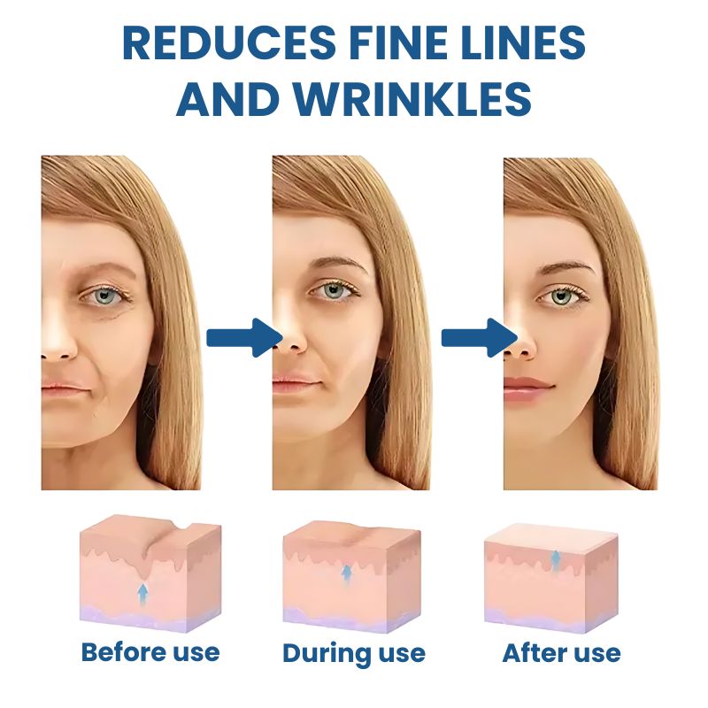 YoungSkin™ | Anti-Ageing Transdermal Patches