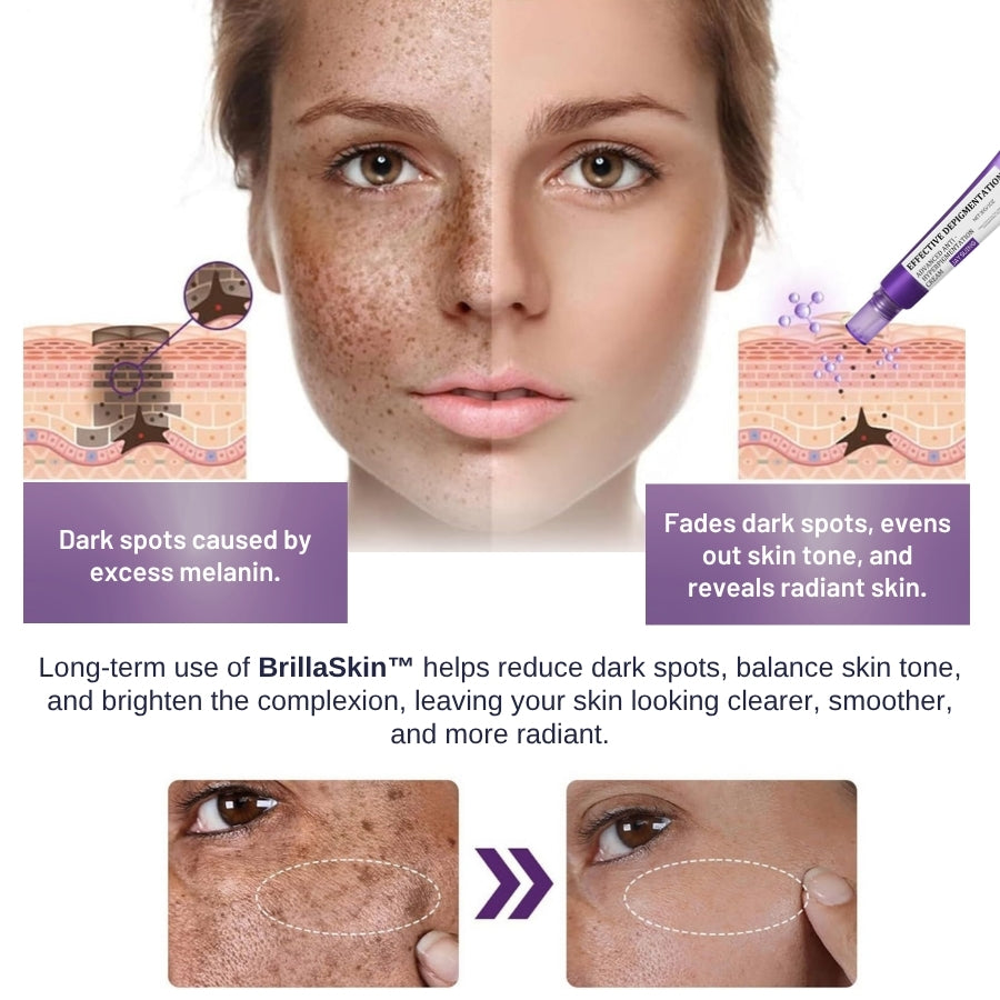 BrillaSkin™ | Advanced Anti-Hyperpigmentation Cream