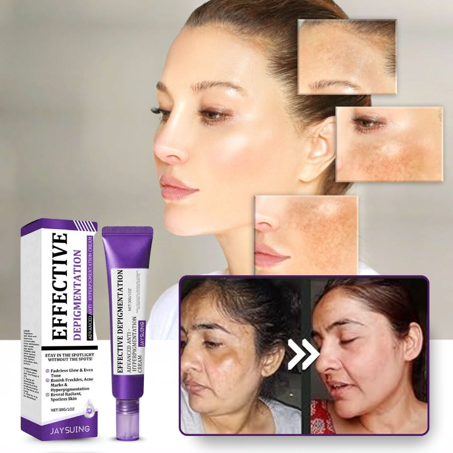 BrillaSkin™ | Advanced Anti-Hyperpigmentation Cream