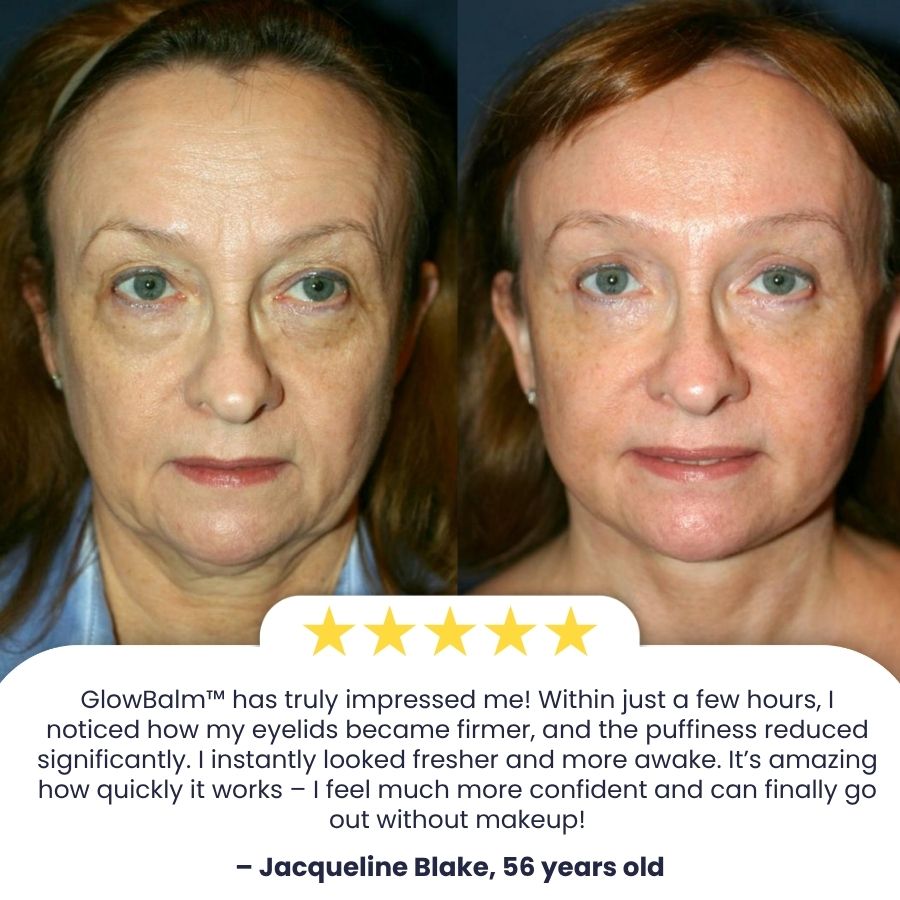 GlowBalm™ | Rosehip Eye Balm