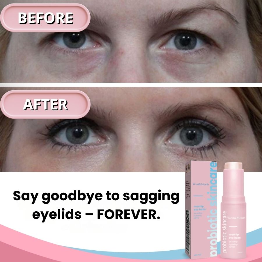 GlowBalm™ | Rosehip Eye Balm