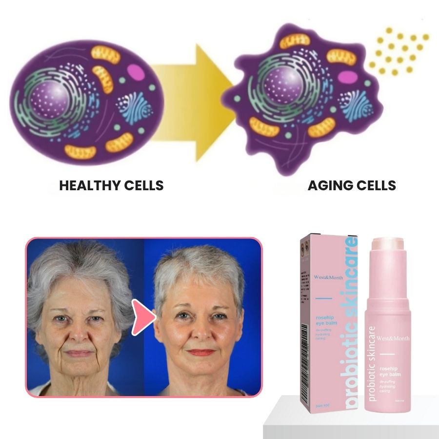 GlowBalm™ | Rosehip Eye Balm