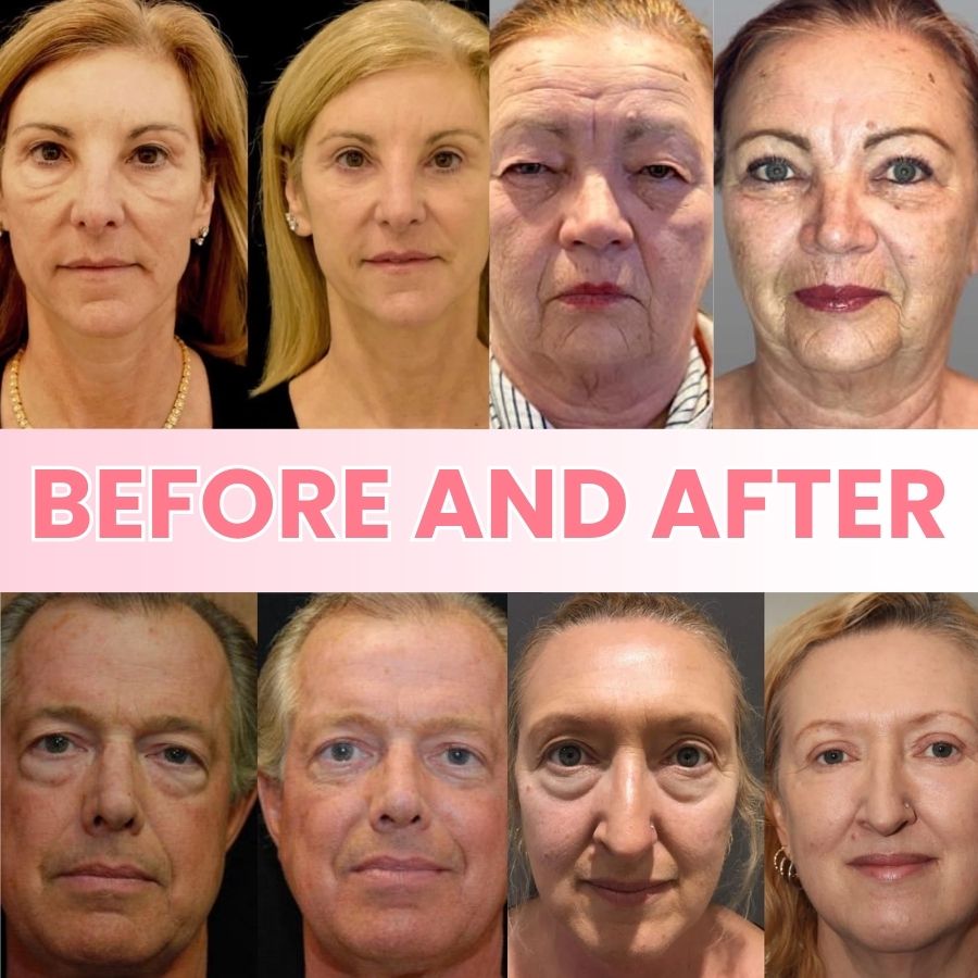 GlowBalm™ | Rosehip Eye Balm