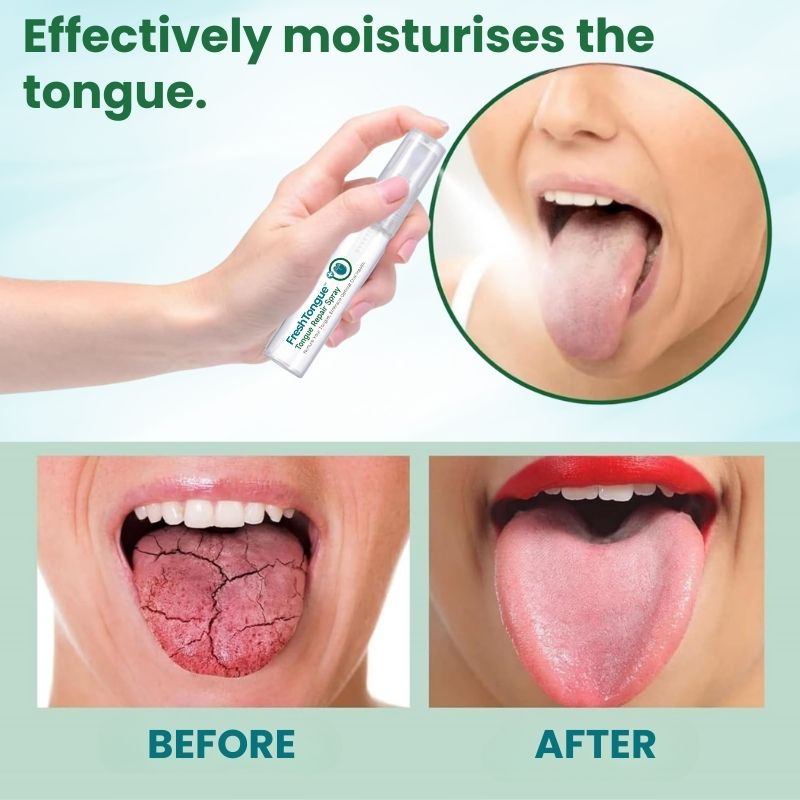 FreshTongue™ | Tongue Repair Spray