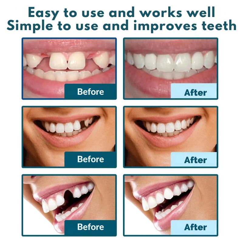 DentalCare™ | Smile without worries in just one second!