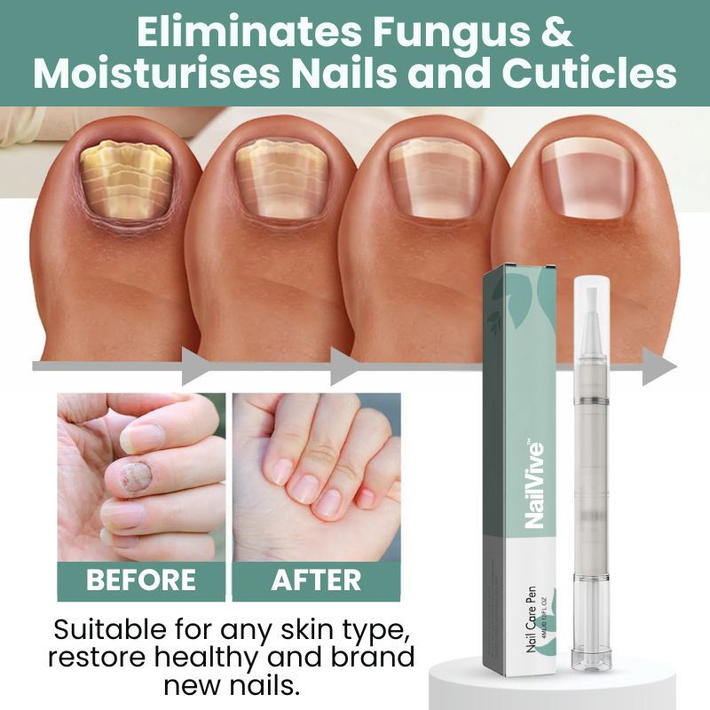 NailVive™ | Toenil Fungus Pen