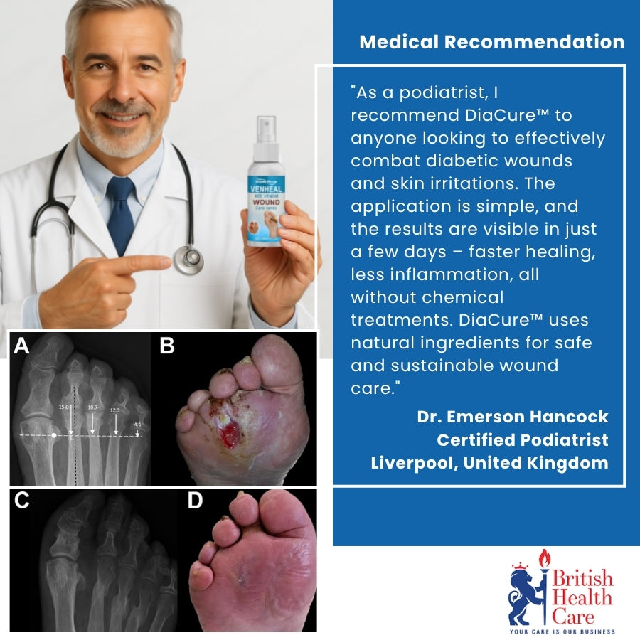 DiaCure™ | VenHeal Bee Venom Diabetic Wound Spray