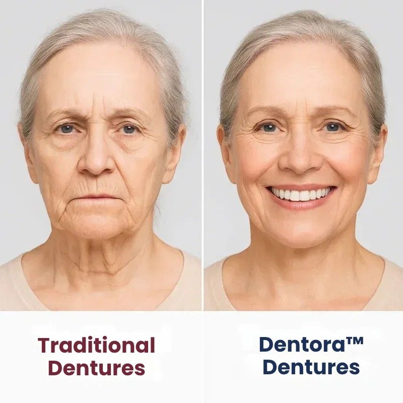 Dentora™ | Instant Denture