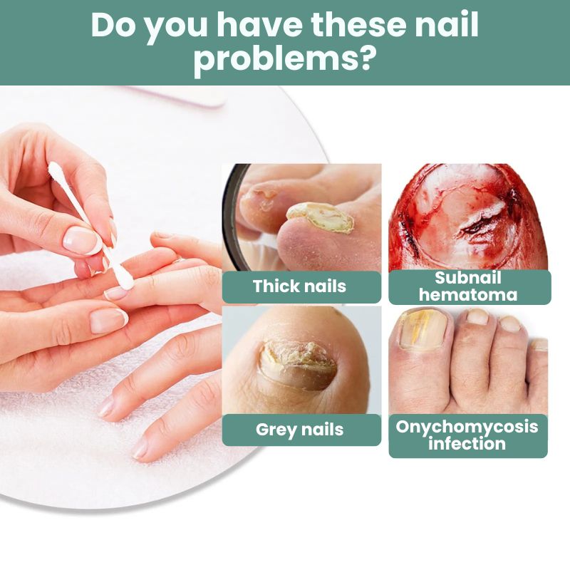 NailVive™ | Toenil Fungus Pen