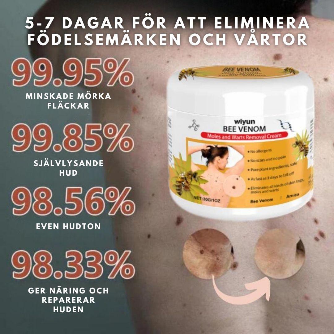HudKlar™ | Bli av med irriterande hudvårtor på bara 7 Dagar!