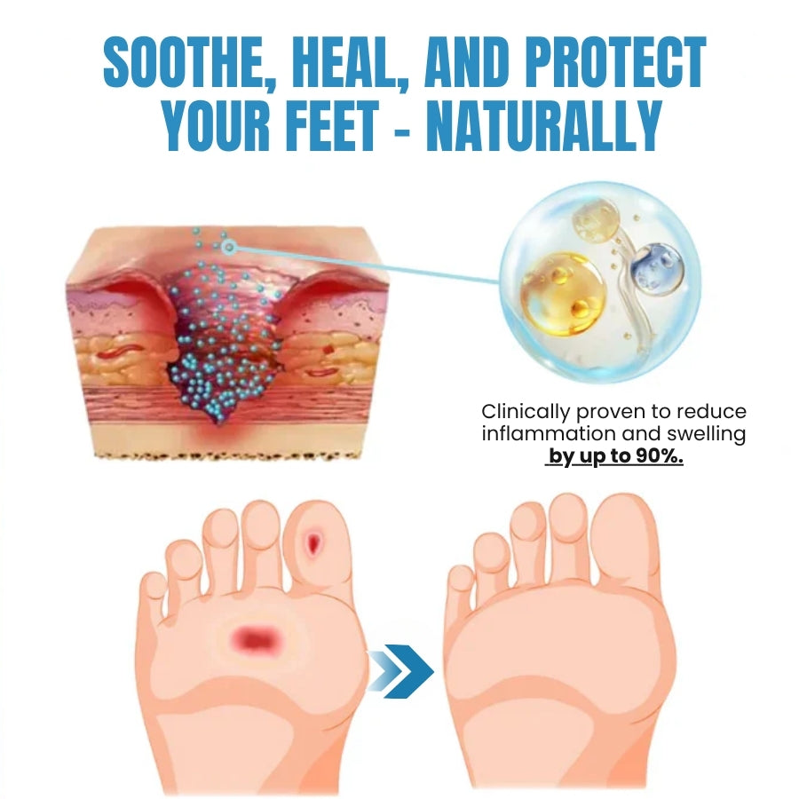 DiaCure™ | VenHeal Bee Venom Diabetic Wound Spray