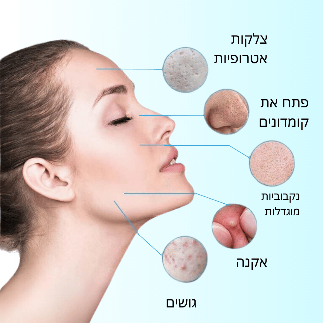 RadiantGlow | סרום לתיקון איזון