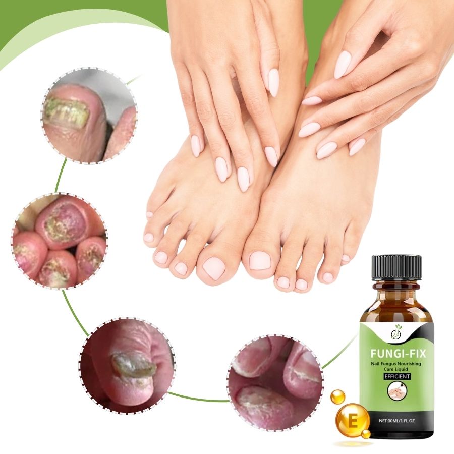 Fungi-Fix™ | Nail Fungus Treatment Serum