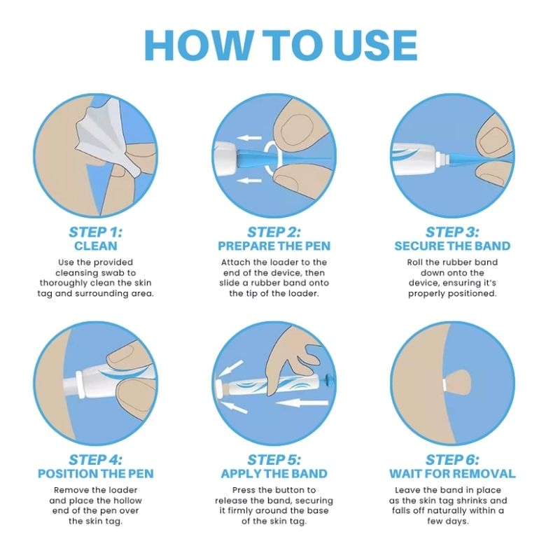 TagSlip™ | Painless Skin Tag Remover