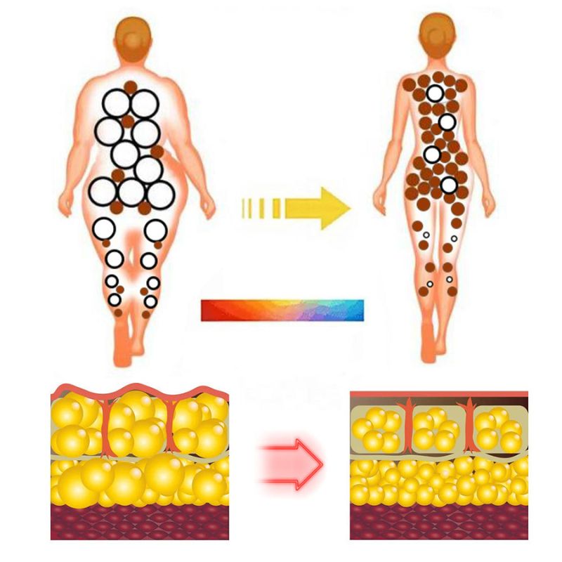SlimPulse™ | Ultrasonic Detox Wristband for Fat Burning & Blood Sugar Regulation