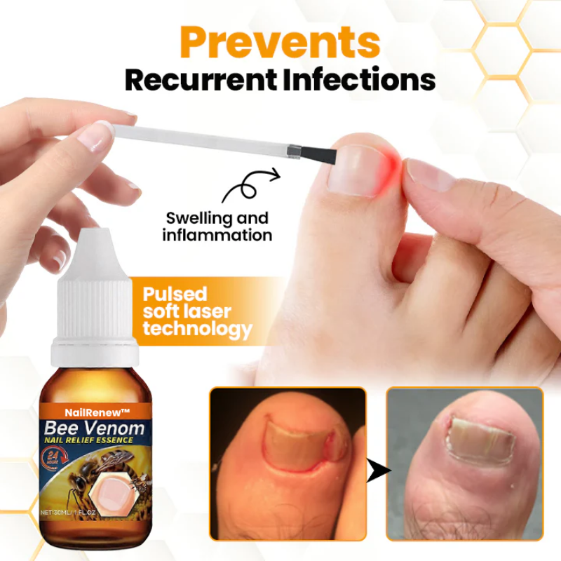 NailRenew™ | Antifungal Nail Renewal Oil