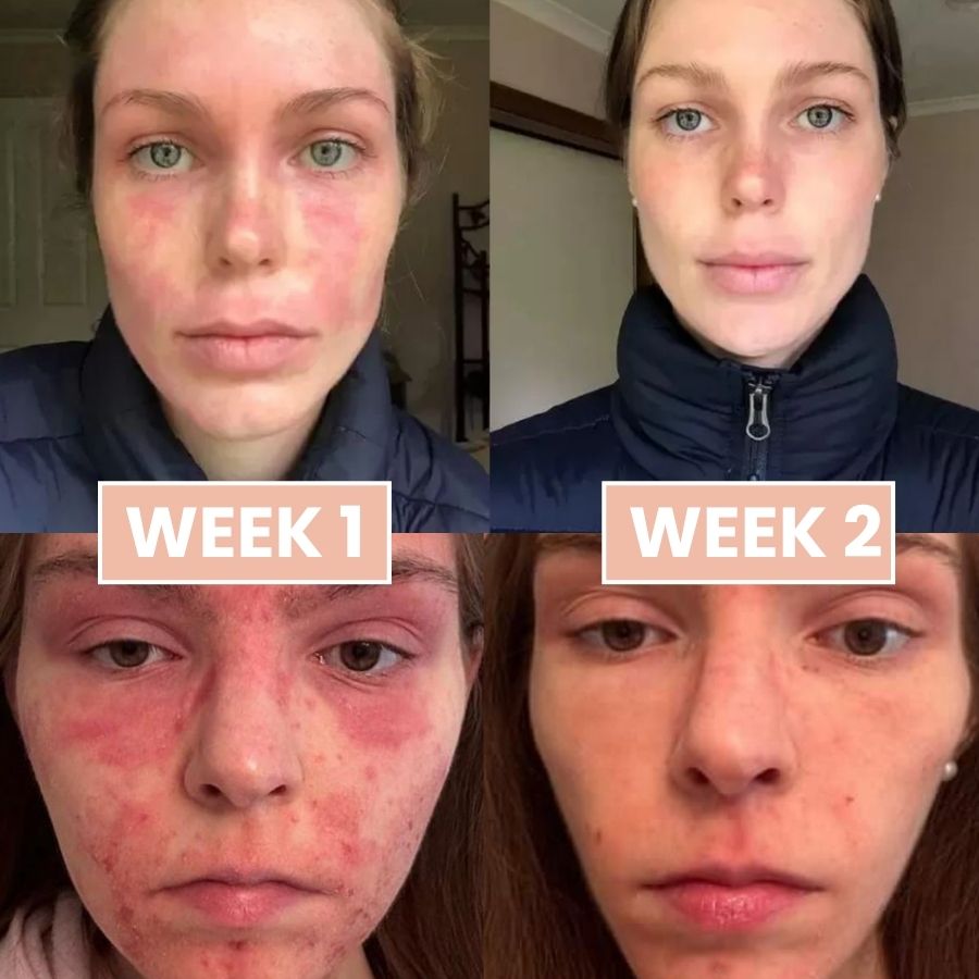 EvoGlow™ | Cleansing Peeling Gel