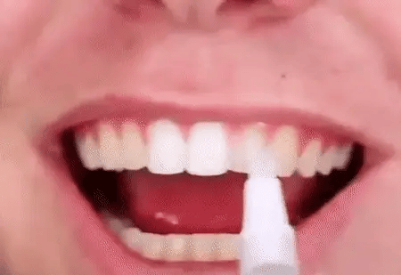 SmileGlow™ | שיניים לבנות וזוהרות תוך 3 שניות בלבד!