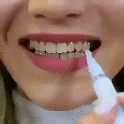 SmileGlow™ | שיניים לבנות וזוהרות תוך 3 שניות בלבד!