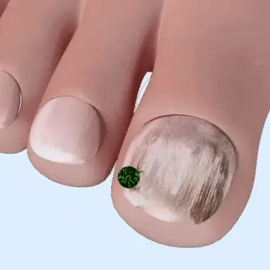 NailRevive™ | תגיד שלום לציפורניים פטרייתיות תוך 7 ימים בלבד!