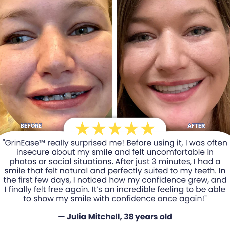 GrinEase™ | Get a Radiant Smile in Just 3 Minutes!