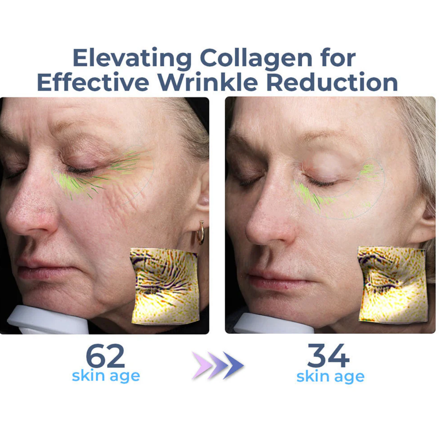 RevitaGlow™ | Erase 95% of Wrinkles, Lift Your Eyes!