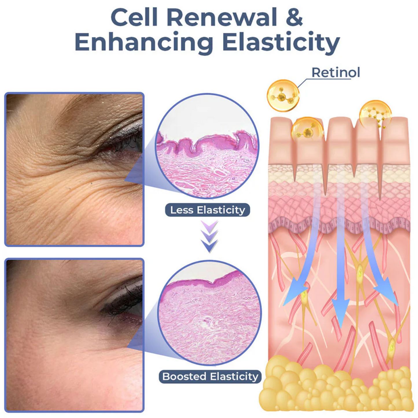RevitaGlow™ | Erase 95% of Wrinkles, Lift Your Eyes!