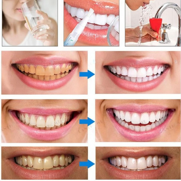 SmileGlow™ | שיניים לבנות וזוהרות תוך 3 שניות בלבד!