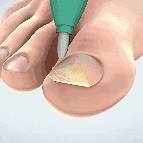 NailRevive™ | תגיד שלום לציפורניים פטרייתיות תוך 7 ימים בלבד!