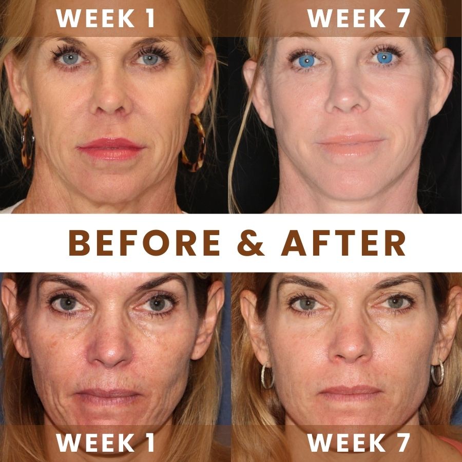 AgeGlow™ | Anti-Aging Retinol Cream