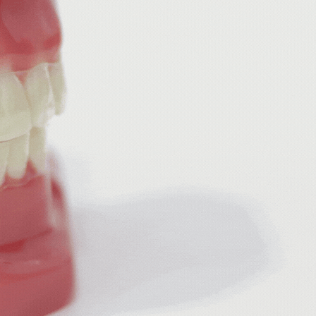 SmileForm™ | Silicone Reline Denture Set