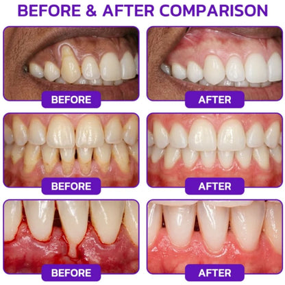 VioCore™ | Bee Venom Toothpaste