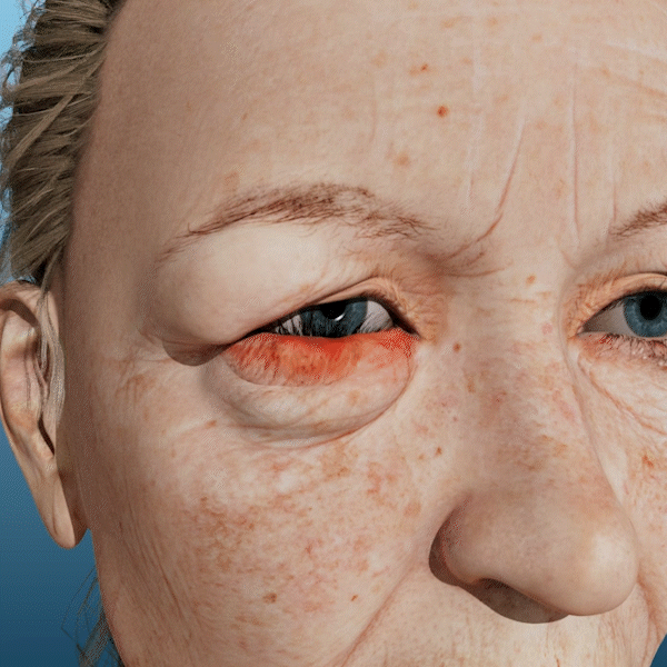 TightGaze™ | Under-Eye Rolling Cream