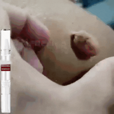 DermaFix™ | Tags & Moles Remover Serum Pen