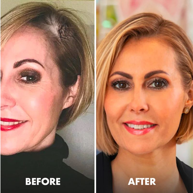 HairCure™ | Hair Strengthening Spray