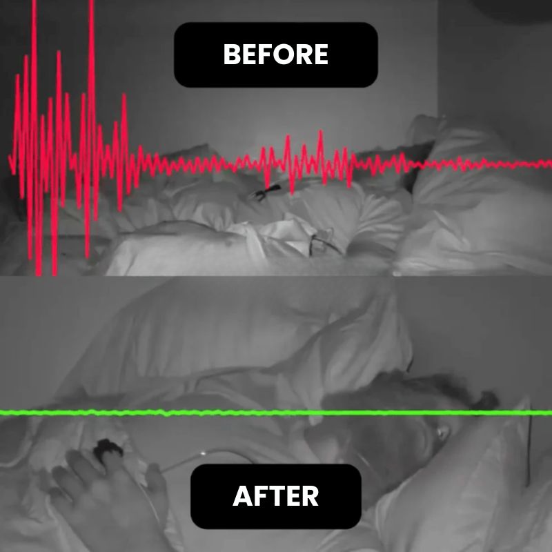 SleepEase™ | Anti-Snoring & Sleep Improvement Band