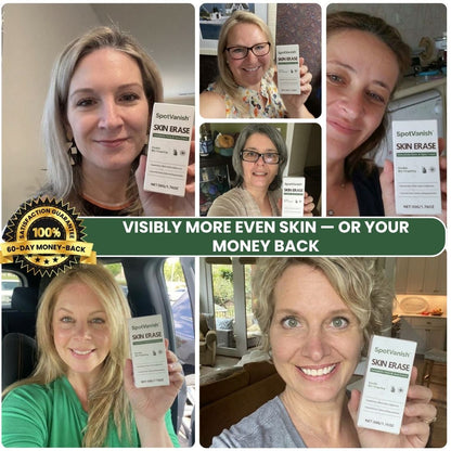 SpotVanish™ | Immediate Mole & Spot Cream