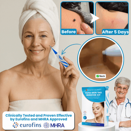 TagSlip™ | Painless Skin Tag Remover