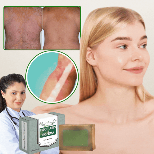 CrocDerma™ | Crocodile Oil Soap for Psoriasis and Eczema