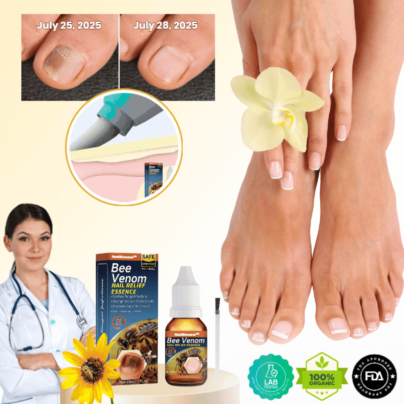 NailRenew™ | Antifungal Nail Renewal Oil