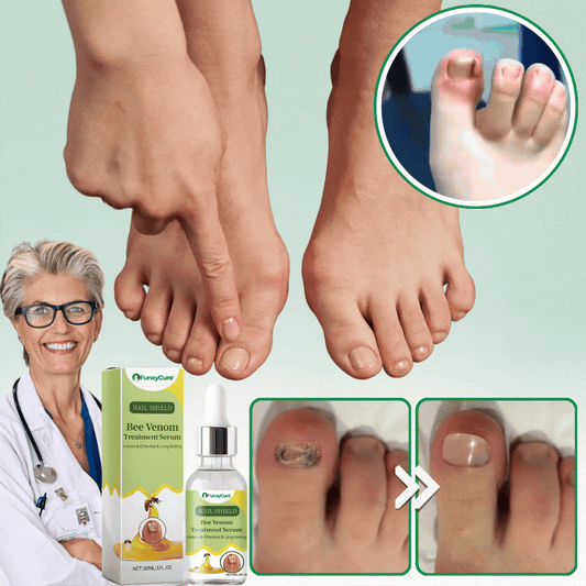 FunxyCure™ | Anti-Fungal Serum