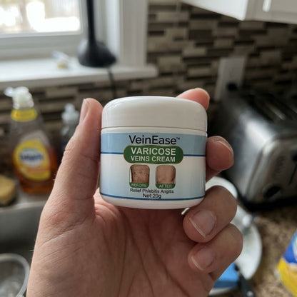 VeinEase™ | Varicose Veins Cream