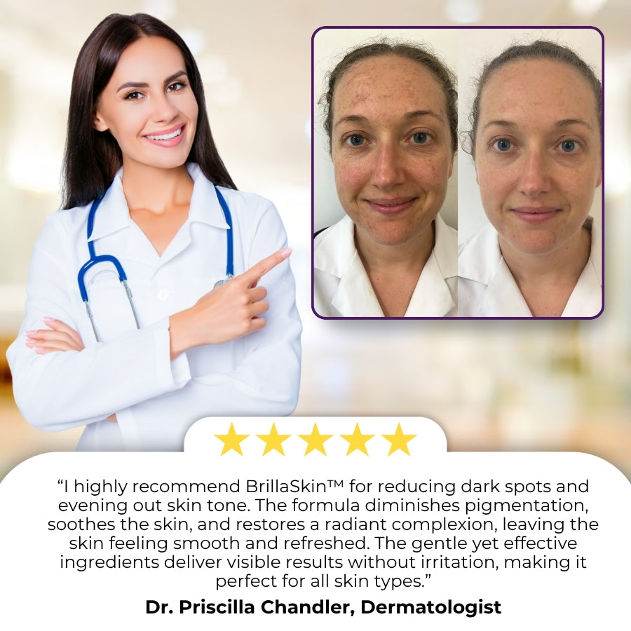 BrillaSkin™ | Advanced Anti-Hyperpigmentation Cream
