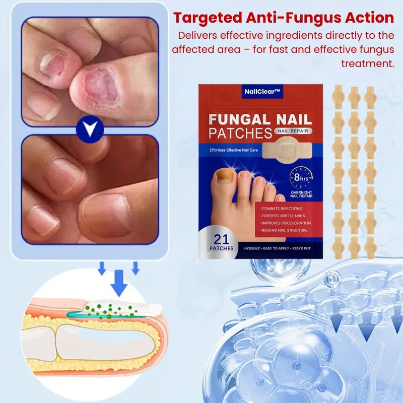 NailClear™ | Nail Fungus Removal Patch